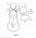 Fig. 10 - Mesh anchored combustion internal combustion engine