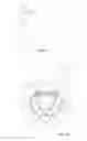 Fig. 02 - Rotating piston internal combustion engine