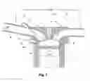 Fig. 02 - Internal Combustion Engine Having a Splitted Fuel Admission and a Respective Combustion Process