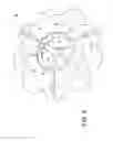 Fig. 07 - Checker nut for locking a threaded body to a threaded rod and concrete reinforcement assembly