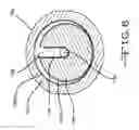 Fig. 07 - Ball nut assembly for an electromechanically actuable parking brake assembly of a brake assembly