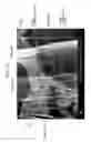 Fig. 13 - Wavelength converter containing phosphor particles