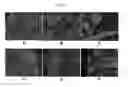 Fig. 04 - ENGINEERED THREE-DIMENSIONAL BREAST TISSUE, ADIPOSE TISSUE, AND TUMOR DISEASE MODEL