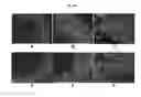 Fig. 07 - ENGINEERED THREE-DIMENSIONAL BREAST TISSUE, ADIPOSE TISSUE, AND TUMOR DISEASE MODEL