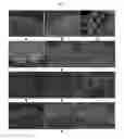 Fig. 09 - ENGINEERED THREE-DIMENSIONAL BREAST TISSUE, ADIPOSE TISSUE, AND TUMOR DISEASE MODEL