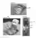 Fig. 28 - Methods and compositions for detecting multiple analytes with a single signal