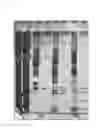 Fig. 13 - MMP-8 activation product, its determination and use