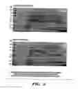 Fig. 03 - METHODS FOR DIAGNOSIS AND PROGNOSIS OF EPITHELIAL CANCERS