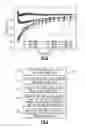 Fig. 05 - Radio-frequency voltage detection
