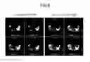 Fig. 07 - Scan condition determining apparatus and method for a magnetic resonance imaging system