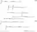 Fig. 75 - Nonlinear imaging with dual band pulse complexes