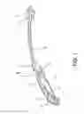 Fig. 02 - EYEGLASS TEMPLE OF COMPOSITE MATERIAL