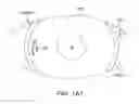 Fig. 09 - Conformable therapeutic shield for vision and pain