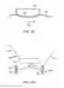 Fig. 41 - Conformable therapeutic shield for vision and pain