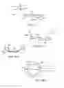 Fig. 43 - Conformable therapeutic shield for vision and pain