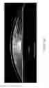 Fig. 60 - Conformable therapeutic shield for vision and pain