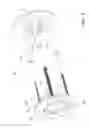 Fig. 06 - High-definition pylon-mounted camera assembly with mounting structure