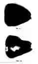 Fig. 02 - CAMERA COVER