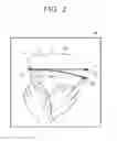 Fig. 03 - Input apparatus