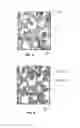 Fig. 03 - METHOD FOR 3-D PRINTING A CUSTOM BONE GRAFT