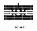 Fig. 12 - METHOD FOR 3-D PRINTING A CUSTOM BONE GRAFT