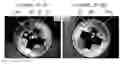 Fig. 01 - Microscope and method for generating a combined image from multiple individual images of an object