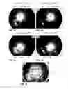 Fig. 04 - Microscope and method for generating a combined image from multiple individual images of an object