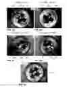 Fig. 05 - Microscope and method for generating a combined image from multiple individual images of an object