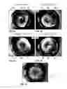 Fig. 06 - Microscope and method for generating a combined image from multiple individual images of an object