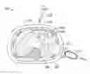 Fig. 01 - Medical device approaches