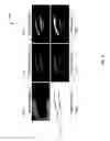 Fig. 10 - Detailed spatio-temporal reconstruction of eyelids