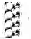 Fig. 22 - Detailed spatio-temporal reconstruction of eyelids