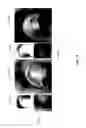 Fig. 24 - Detailed spatio-temporal reconstruction of eyelids