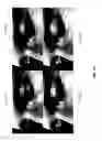 Fig. 25 - Detailed spatio-temporal reconstruction of eyelids