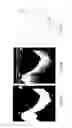 Fig. 07 - Guidewire detection systems, methods, and apparatuses