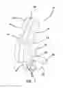 Fig. 02 - Appendectomy model