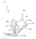 Fig. 01 - Guitar capo with universal device mount