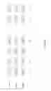 Fig. 22 - Inserting watermarks into audio signals that have speech-like properties
