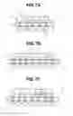 Fig. 10 - Resin-encapsulatd semiconductor device and method of manufacturing the same