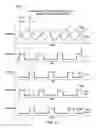 Fig. 10 - Time-interleaved current feedback droop function for multiphase buck converters