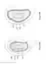 Fig. 07 - Eartip that conforms to a user's ear canal