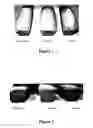 Fig. 02 - FAT REPLACERS AND FILLING MATERIALS