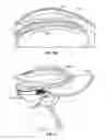 Fig. 16 - Headgear accessory attachment apparatus