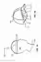 Fig. 02 - APPARATUS FOR USE WITH HAT