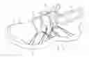 Fig. 01 - ARTICLE OF FOOTWEAR WITH DYNAMIC TENSIONING SYSTEM