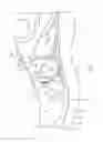 Fig. 06 - ARTICLE OF FOOTWEAR WITH DYNAMIC TENSIONING SYSTEM