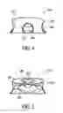 Fig. 05 - Pillow structure