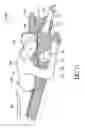 Fig. 09 - Pillow structure