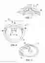 Fig. 03 - Stemware stabilizer