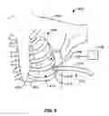 Fig. 07 - Apparatus and methods for facilitating treatment of tissue via improved delivery of energy based and non-energy based modalities